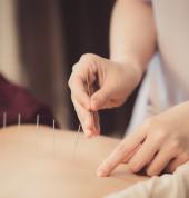 Acupuncture un process