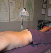 acupuncture for a lower back/glute condition