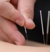 Bay Chinese Acupuncture centre