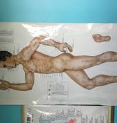 Green and Nature Therapy Sandringham (1025) Chinese Massage 3_small