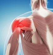 Infrared Light Therapy: Sport injury recovery