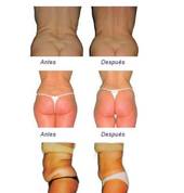 BodyShapers Manurewa (2102) Day Spas 4_small