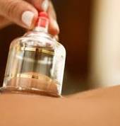 Cupping Therapy
