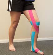 Ideal for sports injuries, Kinesio taping is a treatment used regularly.