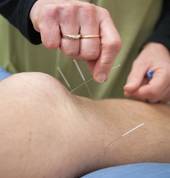 Acupuncture can be used in many conditions - boith injury and life style issues gain benefits from acupuncture.