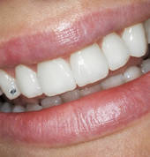 Sparklewhite Teeth Christchurch Central (8011) Dental 2_small