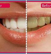 Sparklewhite Teeth Christchurch Central (8011) Dental 4_small